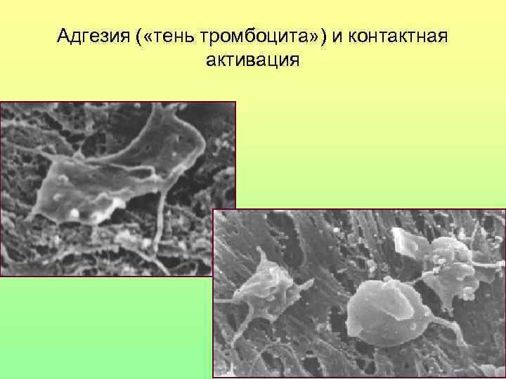 Адгезия ( «тень тромбоцита» ) и контактная   активация 