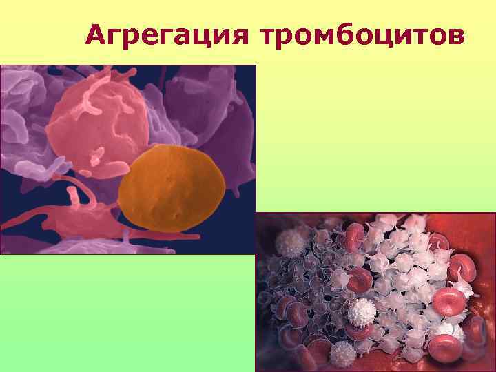 Агрегация тромбоцитов 