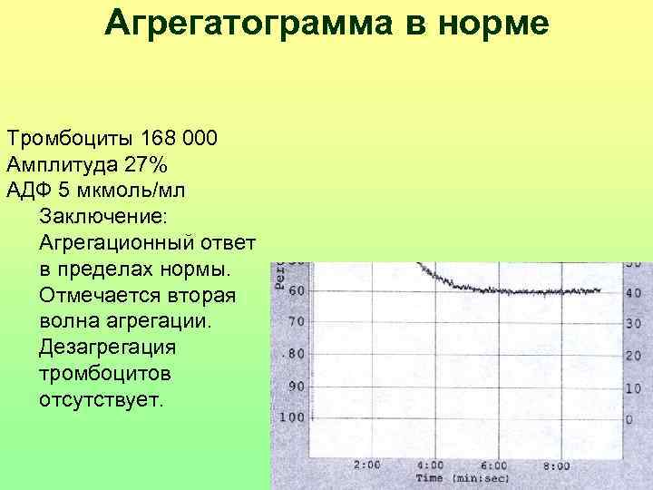   Агрегатограмма в норме  Тромбоциты 168 000 Амплитуда 27% АДФ 5 мкмоль/мл