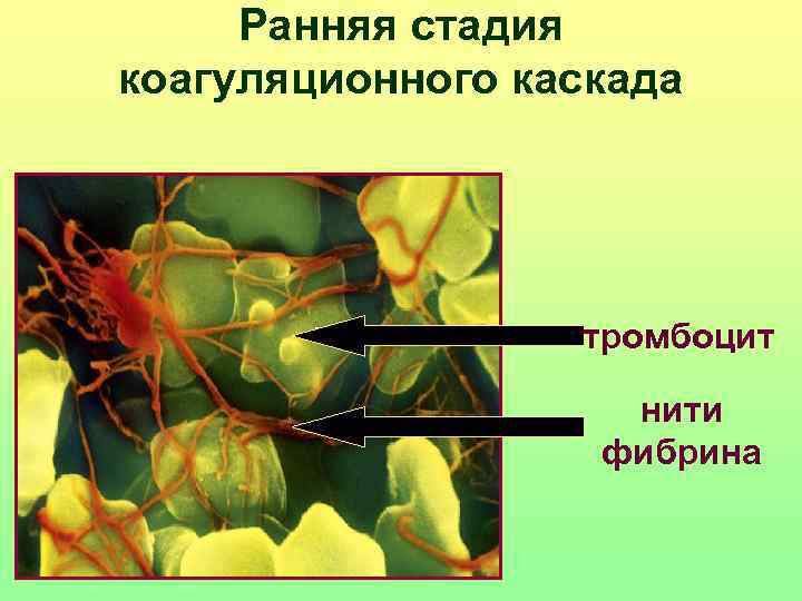  Ранняя стадия коагуляционного каскада    тромбоцит     нити