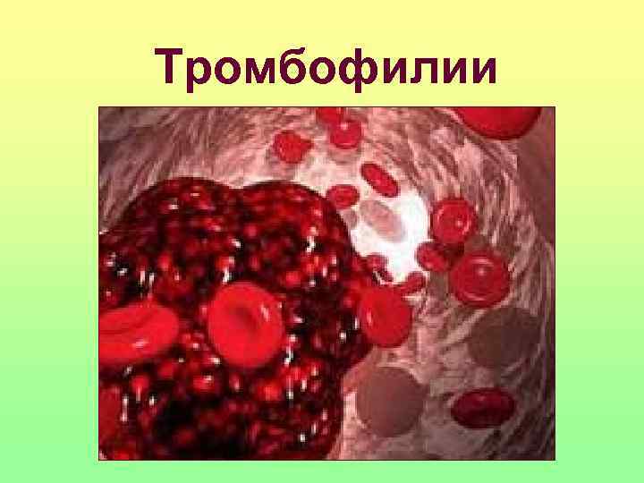 Тромбофилии 