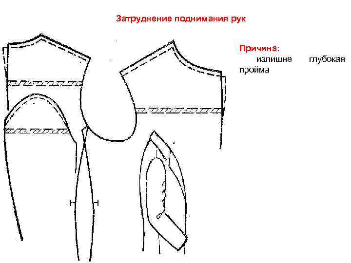 Затруднение поднимания рук      Причина:     излишне