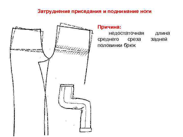 Затруднение приседания и поднимание ноги    Причина:     