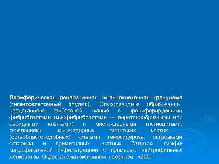 Периферическая репаративная гигантоклеточная гранулема (гигантоклеточный эпулис).  Опухолевидное образование представлено  фиброзной  тканью