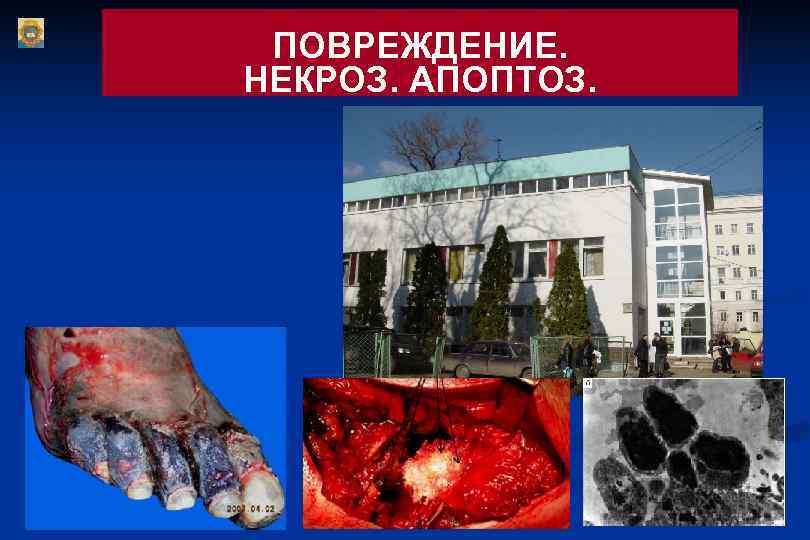 ПОВРЕЖДЕНИЕ. НЕКРОЗ. АПОПТОЗ. ПОВРЕЖДЕНИЕ. НЕКРОЗ. АПОПТОЗ.