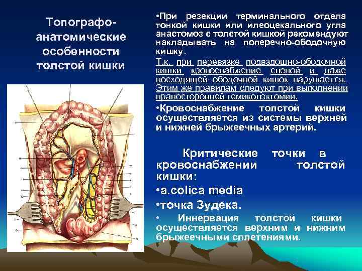    • При резекции терминального отдела Топографо- тонкой кишки илеоцекального угла анатомические