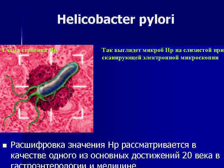 Helicobacter pylori se contagia sexualmente