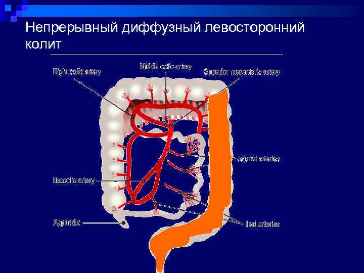 Ишемический колит презентация