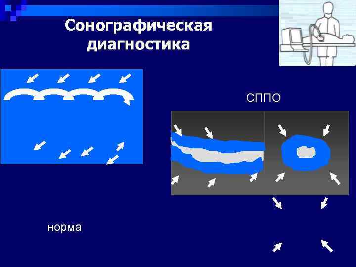  Сонографическая диагностика    СППО норма 