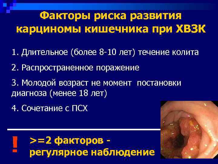  Факторы риска развития карциномы кишечника при ХВЗК 1. Длительное (более 8 -10 лет)