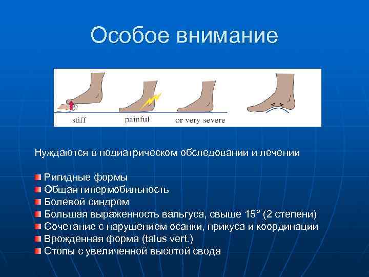    Особое внимание Нуждаются в подиатрическом обследовании и лечении  Ригидные формы