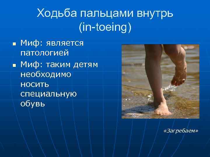   Ходьба пальцами внутрь    (in-toeing) n  Миф: является патологией
