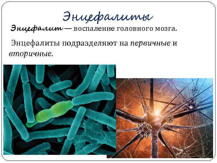   Энцефалиты Энцефалит — воспаление головного мозга.  Энцефалиты подразделяют на первичные и