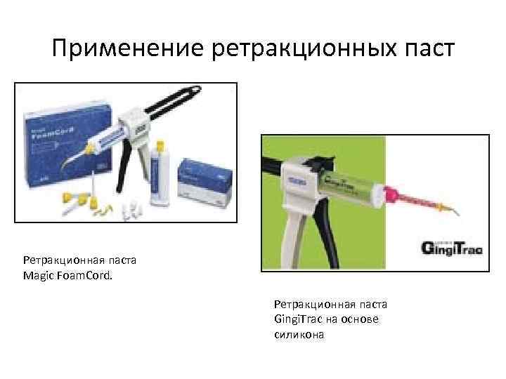 Применение ретракционных паст Ретракционная паста Magic Foam. Cord. Ретракционная паста Gingi. Trac на основе