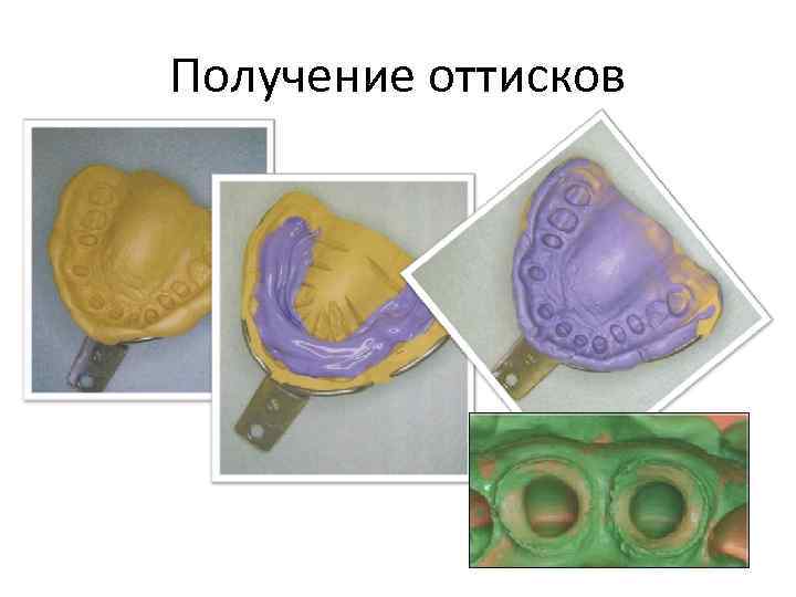 Получение оттисков 