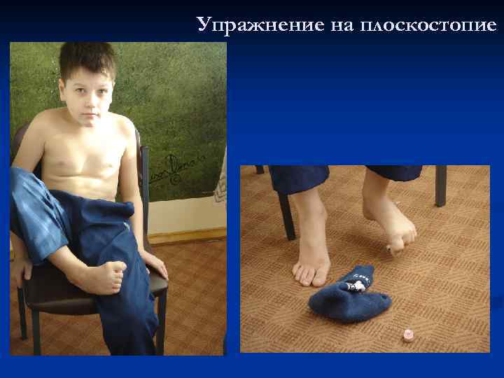 Упражнение на плоскостопие 