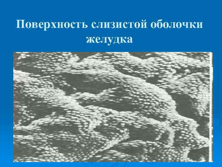 Поверхность слизистой оболочки  желудка 