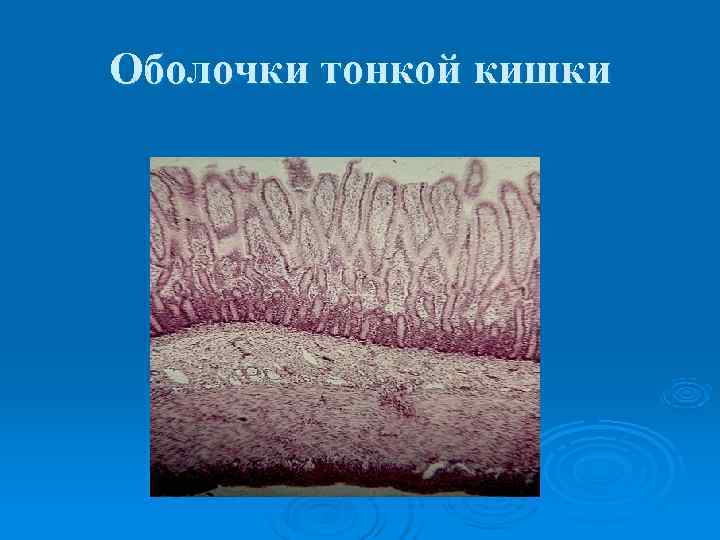 Оболочки тонкой кишки 