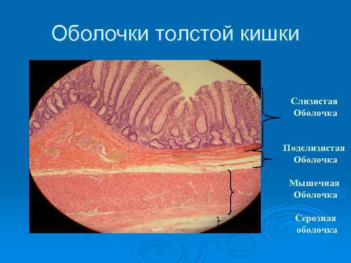 Оболочки толстой кишки    Слизистая     Оболочка  