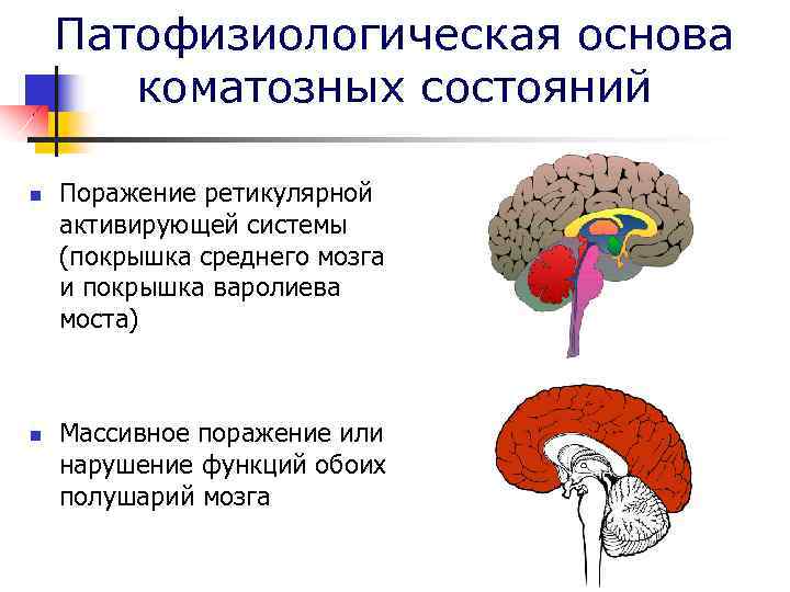   Патофизиологическая основа  коматозных состояний n  Поражение ретикулярной активирующей системы (покрышка