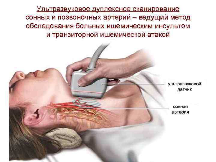   Ультразвуковое дуплексное сканирование сонных и позвоночных артерий – ведущий метод обследования больных