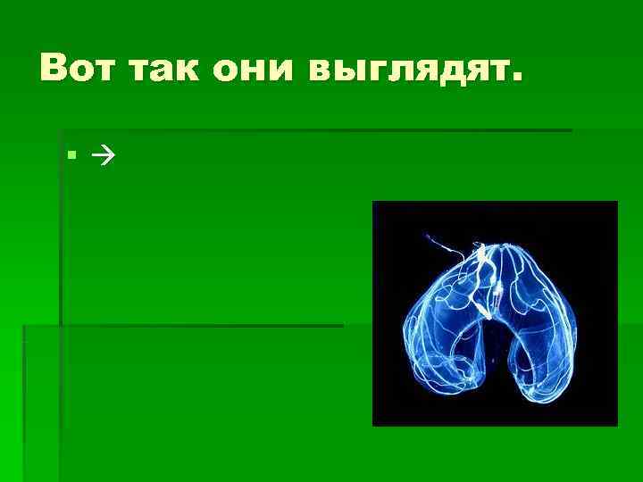 Вот так они выглядят.  § 