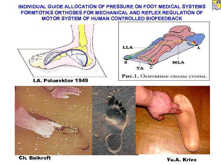 INDIVIDUAL GUIDE ALLOCATION OF PRESSURE ON FOOT MEDICAL SYSTEMS FORMTOTIKS ORTHOSES FOR MECHANICAL AND