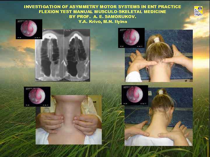 INVESTIGATION OF ASYMMETRY MOTOR SYSTEMS IN ENT PRACTICE FLEXION TEST MANUAL MUSCULO-SKELETAL MEDICINE BY