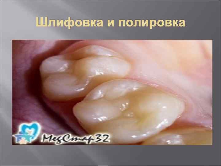 Шлифовка и полировка 