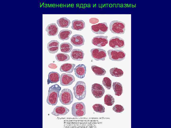 Изменение ядра и цитоплазмы 