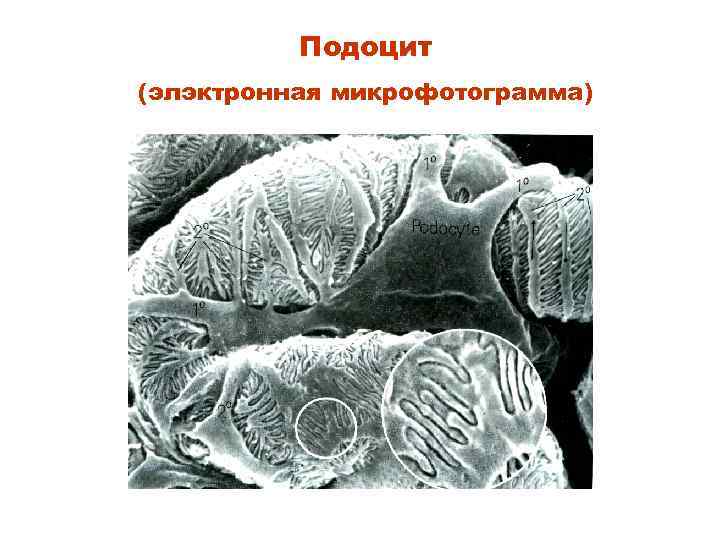    Подоцит (элэктронная микрофотограмма) 