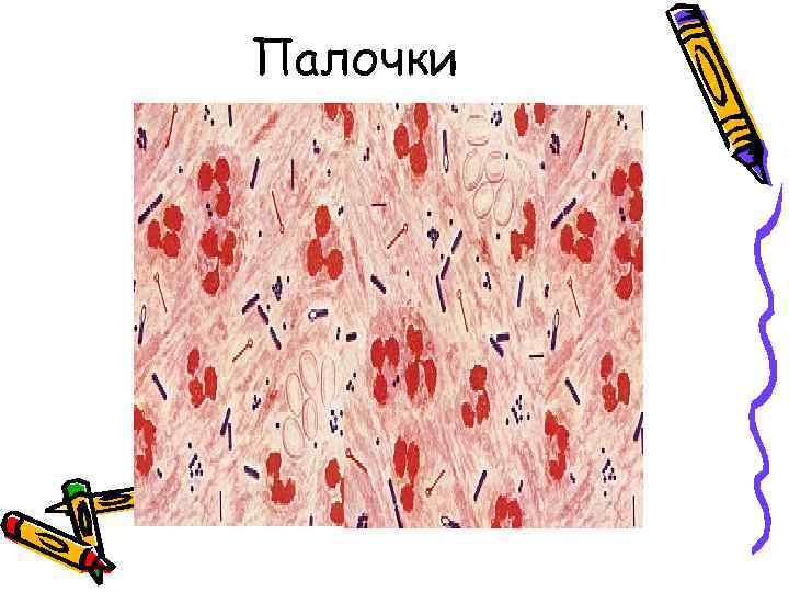 Палочки 