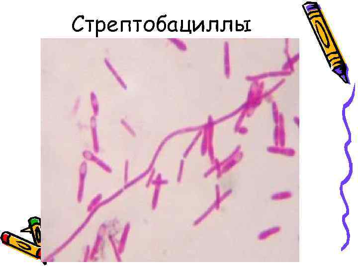 Стрептобациллы 