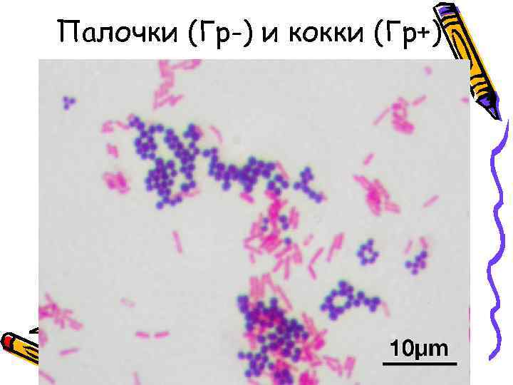Палочки (Гр-) и кокки (Гр+) 