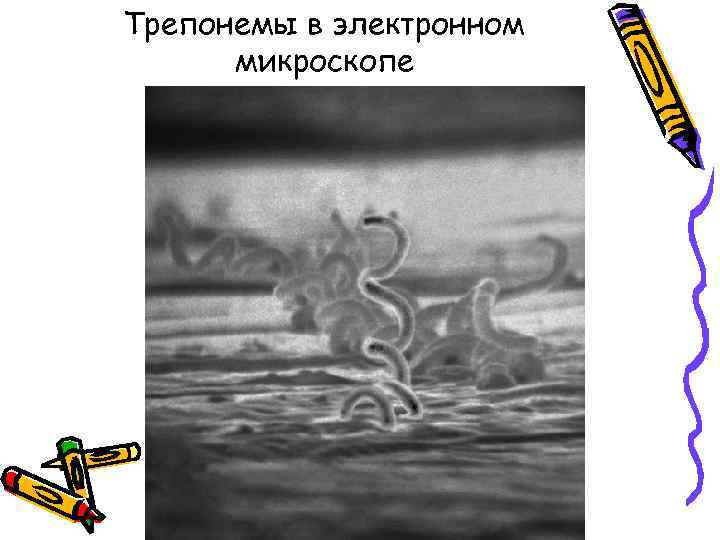 Трепонемы в электронном  микроскопе 