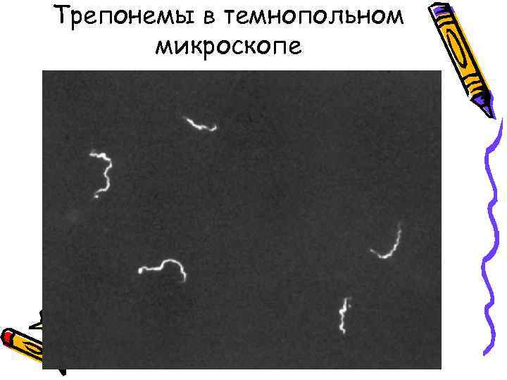 Трепонемы в темнопольном  микроскопе 