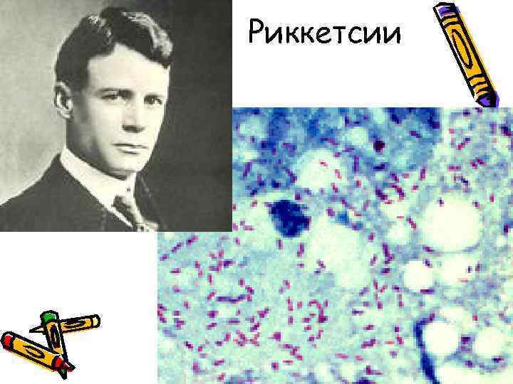    Риккетсии  • Заболевания - 