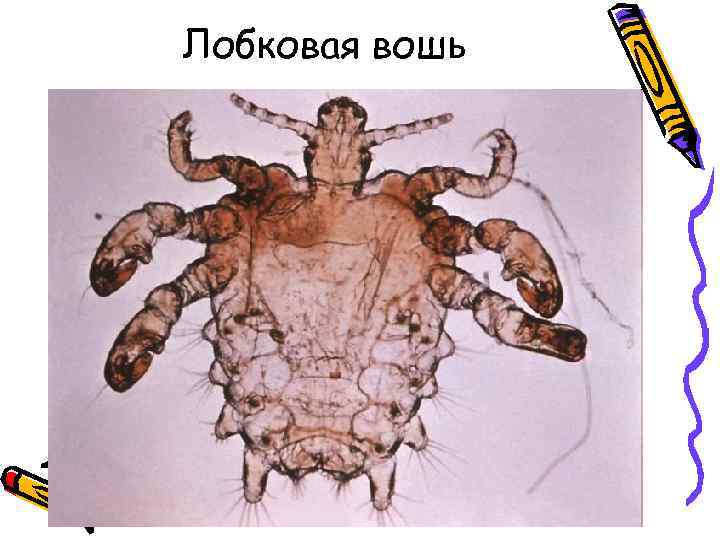 Лобковая вошь 