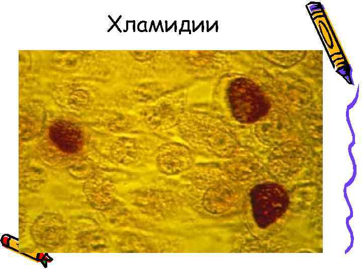   Хламидии  • Заболевания 
