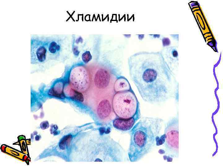 Хламидии 