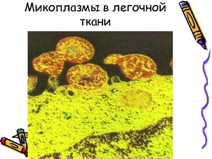 Микоплазмы в легочной   ткани 