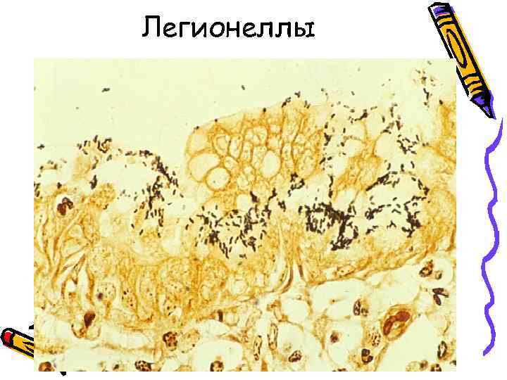 Легионеллы 