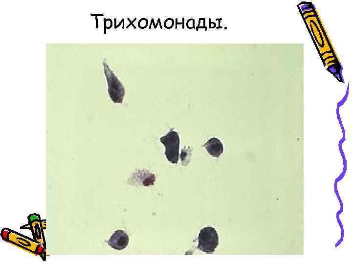 Трихомонады. 