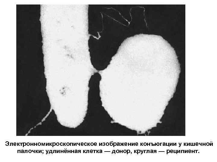 Электронномикроскопическое изображение конъюгации у кишечной  палочки; удлинённая клетка — донор, круглая — реципиент.