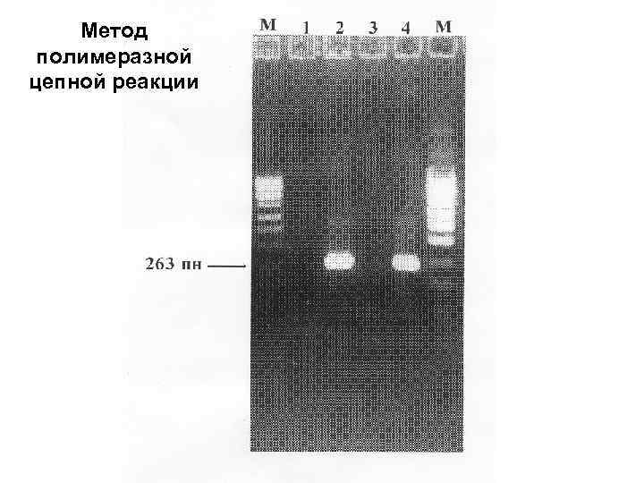   Метод полимеразной цепной реакции 
