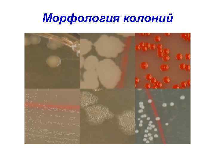 Морфология колоний 