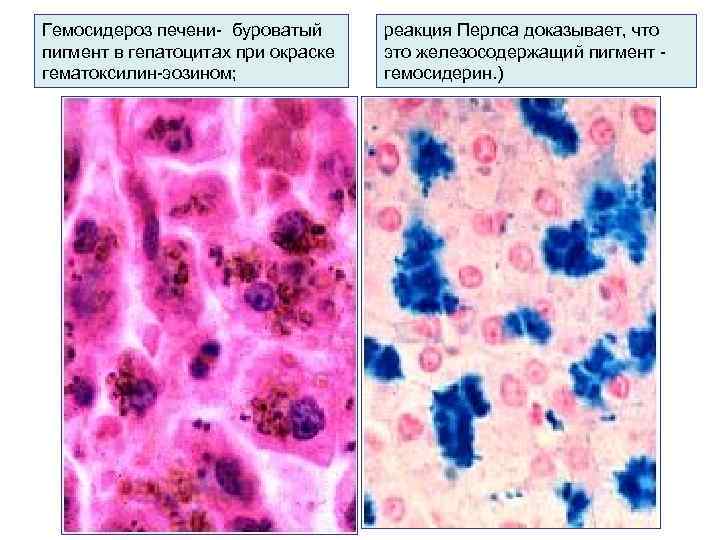 Реакция перлса