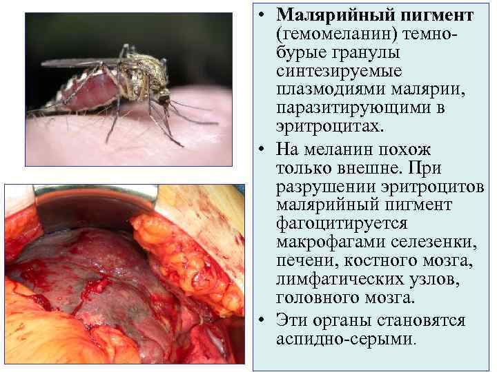  • Малярийный пигмент  (гемомеланин) темно-  бурые гранулы  синтезируемые  плазмодиями
