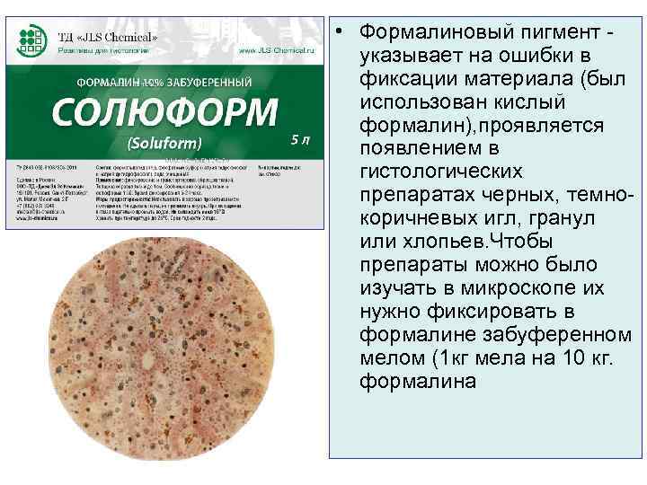  • Формалиновый пигмент -  указывает на ошибки в  фиксации материала (был