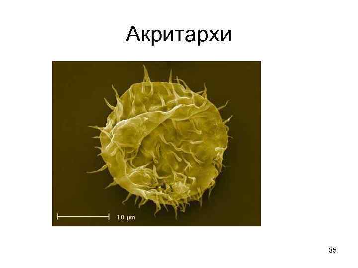 Акритархи   35 